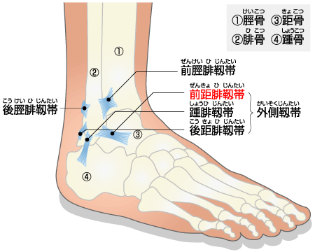 sprain_of_ankle_html